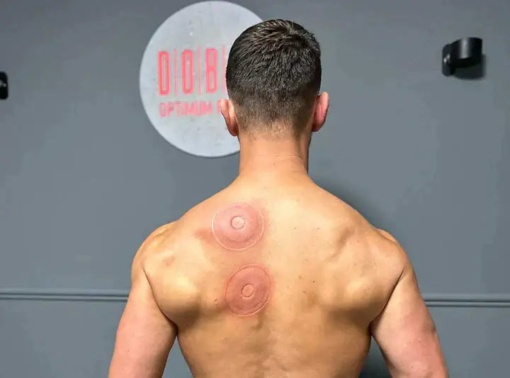 SmartCup – Electric Cupping Therapy Massager with Red Light & Heat Therapy